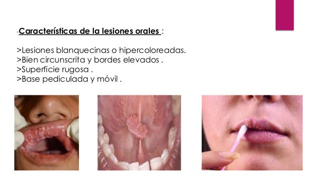 Precauciones